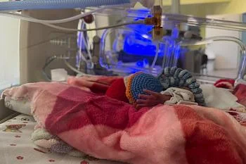 Специальный проект Перинатального центра ко Дню недоношенного ребенка "Спасибо, Доктор"